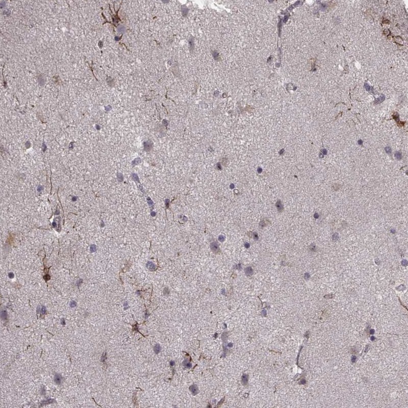 Atlas Antibodies Anti-NTF3 Antibody
