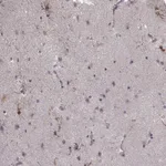 Atlas Antibodies Anti-NTF3 Antibody