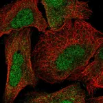 Atlas Antibodies Anti-NTMT1 Antibody