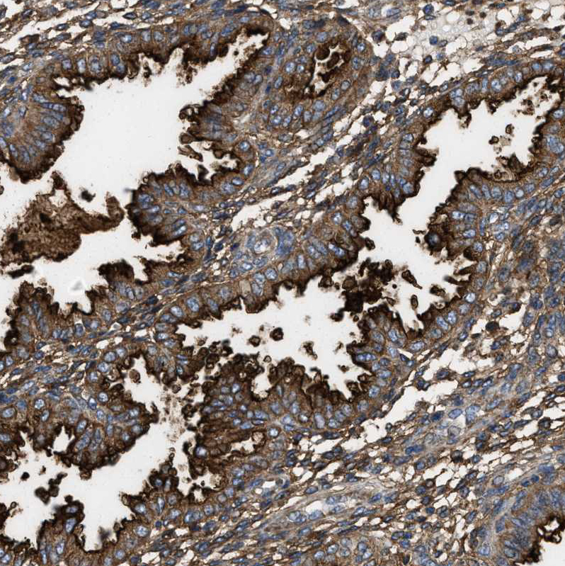 Atlas Antibodies Anti-NT5E Antibody