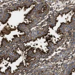 Atlas Antibodies Anti-NT5E Antibody
