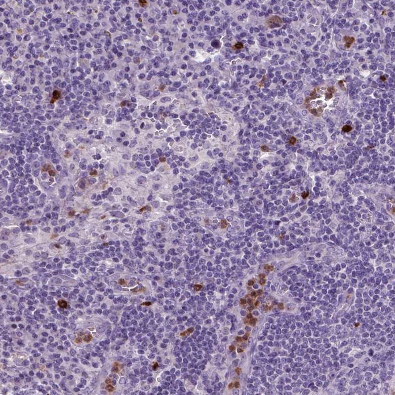 Atlas Antibodies Anti-NTNG2 Antibody