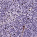 Atlas Antibodies Anti-NTNG2 Antibody