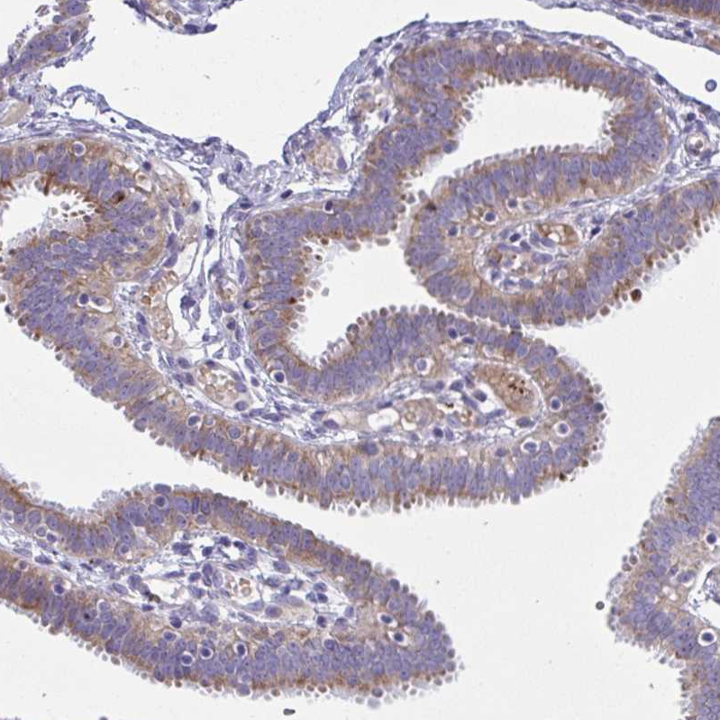Atlas Antibodies Anti-NTN1 Antibody