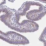 Atlas Antibodies Anti-NTN1 Antibody
