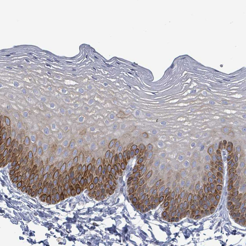 Atlas Antibodies Anti-NTN3 Antibody