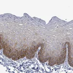 Atlas Antibodies Anti-NTN3 Antibody