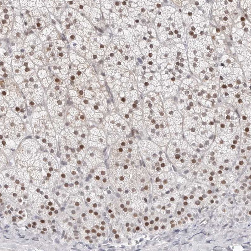 Atlas Antibodies Anti-NTPCR Antibody