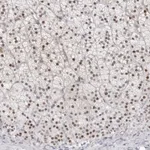 Atlas Antibodies Anti-NTPCR Antibody
