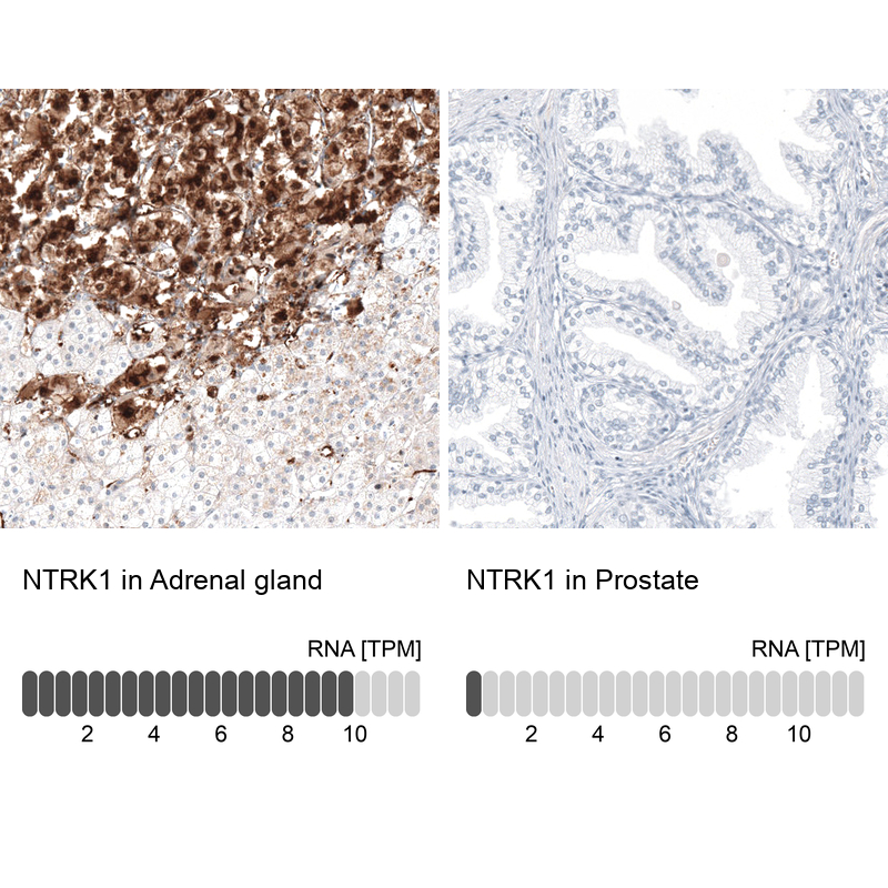 Atlas Antibodies Anti-NTRK1 Antibody