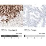 Atlas Antibodies Anti-NTRK1 Antibody