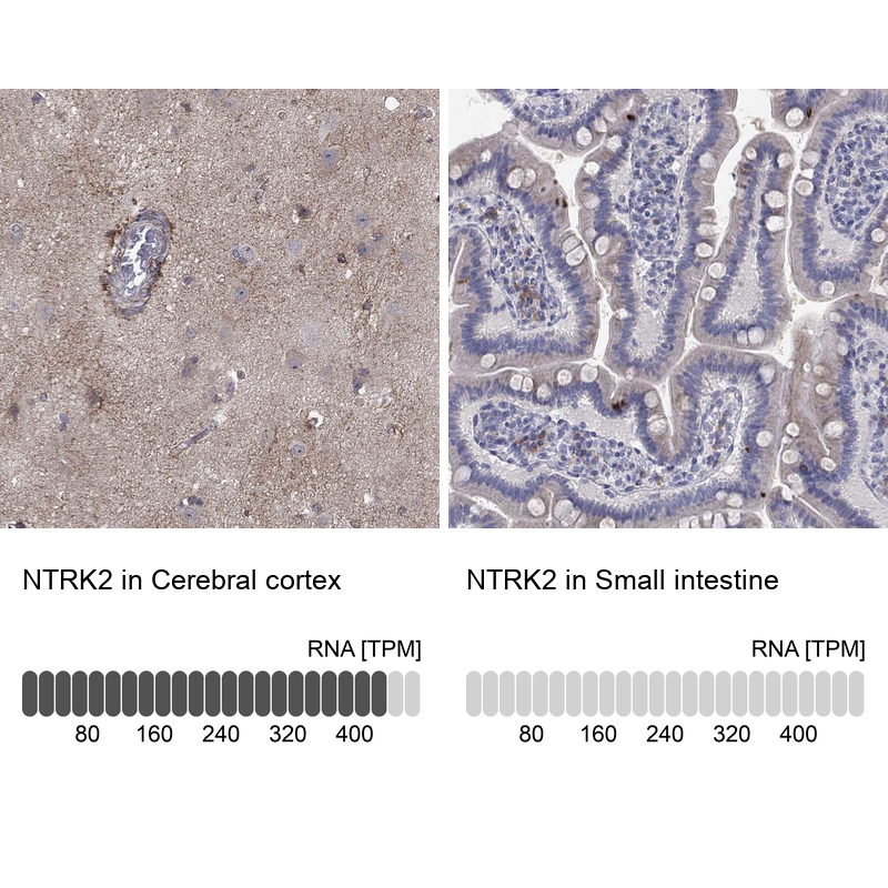 Atlas Antibodies Anti-NTRK2 Antibody