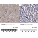 Atlas Antibodies Anti-NTRK2 Antibody
