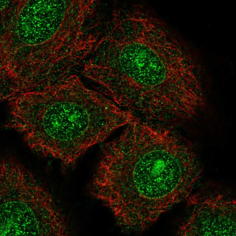 Atlas Antibodies Anti-NTRK3 Antibody