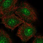 Atlas Antibodies Anti-NTRK3 Antibody