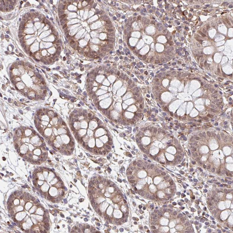 Atlas Antibodies Anti-NUB1 Antibody