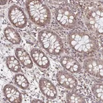 Atlas Antibodies Anti-NUB1 Antibody