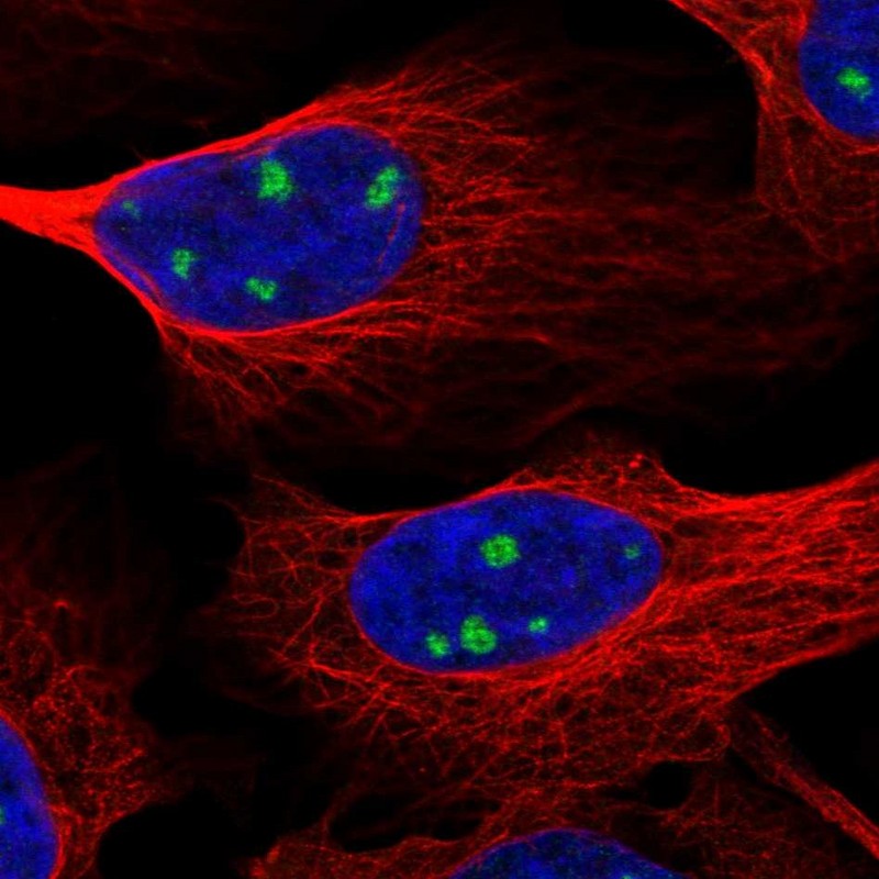 Atlas Antibodies Anti-NTRK3 Antibody