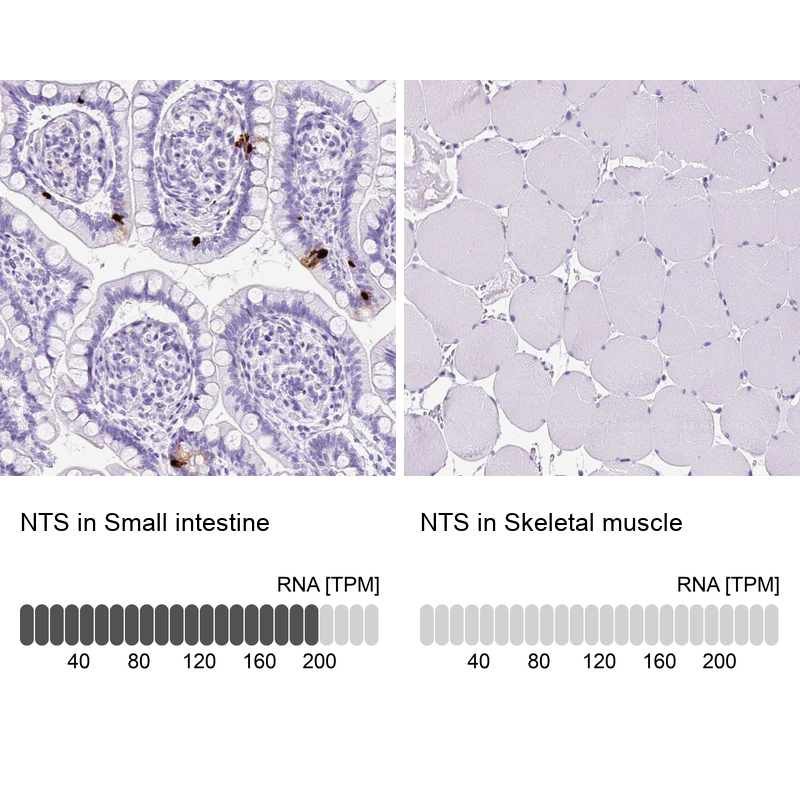 Atlas Antibodies Anti-NTS Antibody