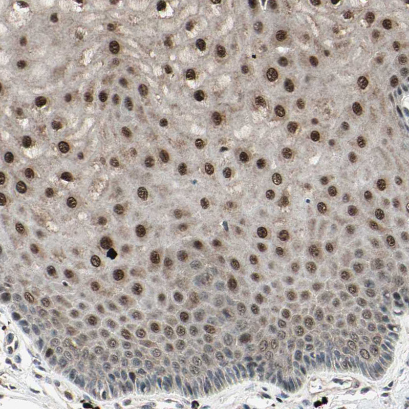 Atlas Antibodies Anti-NUAK2 Antibody