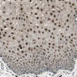 Atlas Antibodies Anti-NUAK2 Antibody
