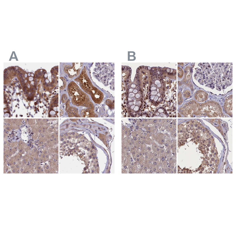 Atlas Antibodies Anti-NUBP1 Antibody