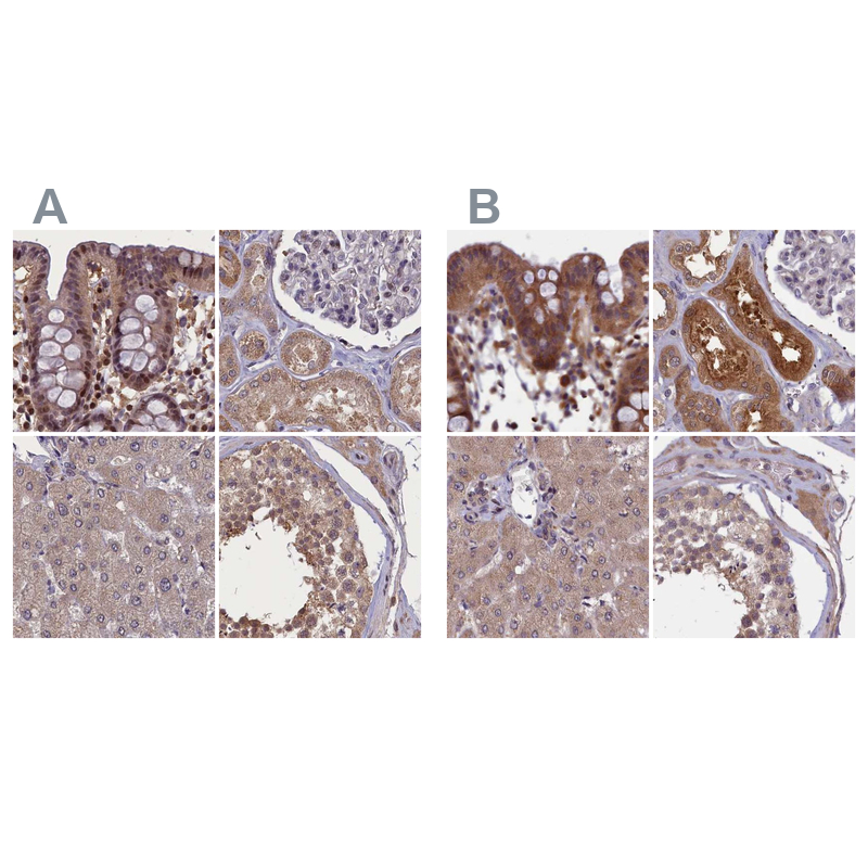 Atlas Antibodies Anti-NUBP1 Antibody