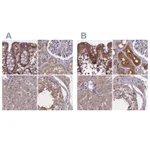 Atlas Antibodies Anti-NUBP1 Antibody
