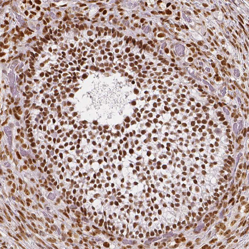 Atlas Antibodies Anti-NUCKS1 Antibody