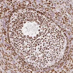 Atlas Antibodies Anti-NUCKS1 Antibody
