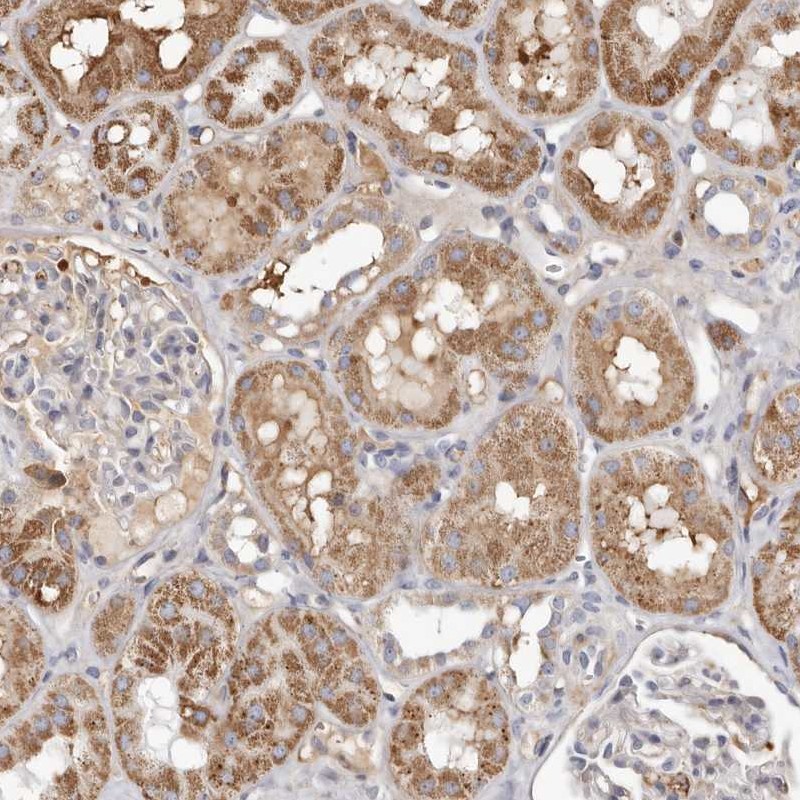 Atlas Antibodies Anti-NUBPL Antibody
