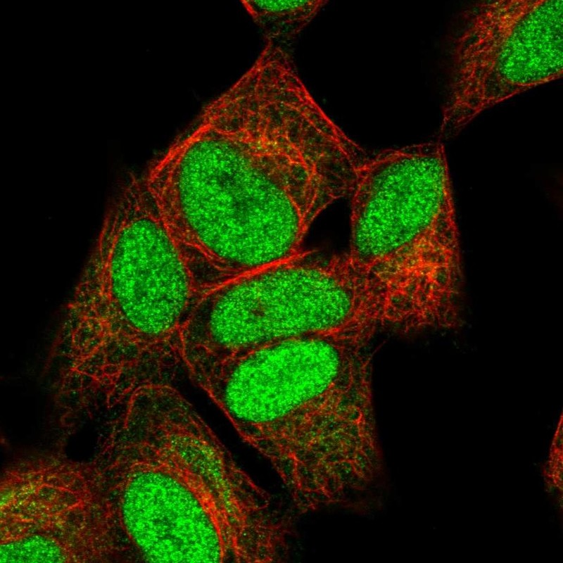 Atlas Antibodies Anti-NUCKS1 Antibody
