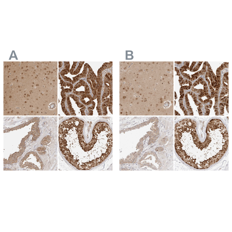 Atlas Antibodies Anti-NUDC Antibody
