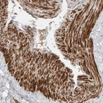 Atlas Antibodies Anti-NUDCD1 Antibody
