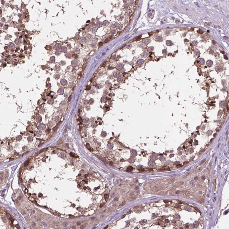 Atlas Antibodies Anti-NUDT1 Antibody