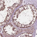 Atlas Antibodies Anti-NUDT1 Antibody