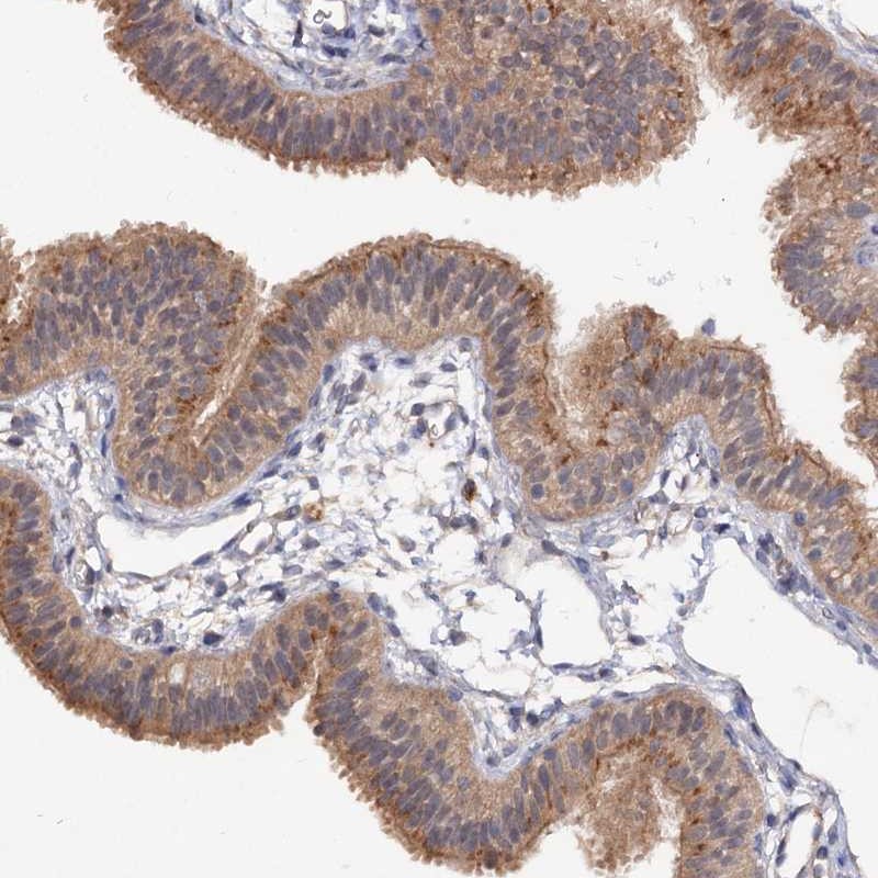 Atlas Antibodies Anti-NUDCD2 Antibody