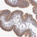 Atlas Antibodies Anti-NUDCD2 Antibody