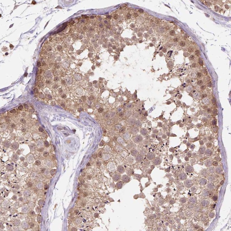 Atlas Antibodies Anti-NUDT10 Antibody