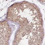 Atlas Antibodies Anti-NUDT10 Antibody