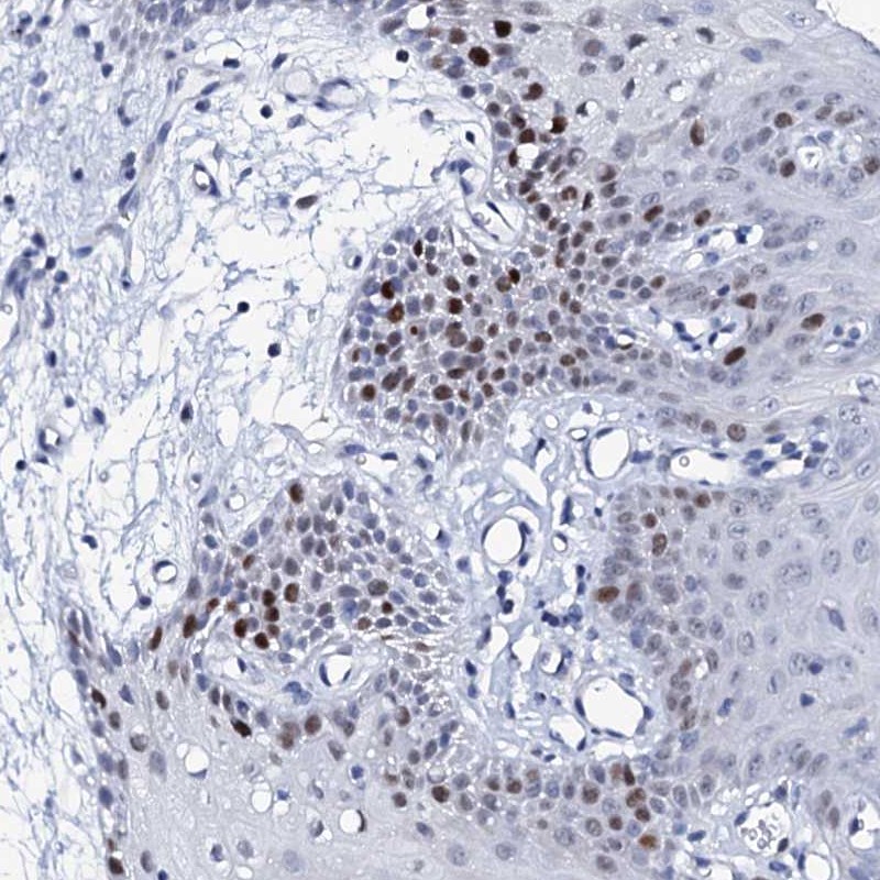 Atlas Antibodies Anti-NUDT13 Antibody
