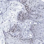 Atlas Antibodies Anti-NUDT13 Antibody