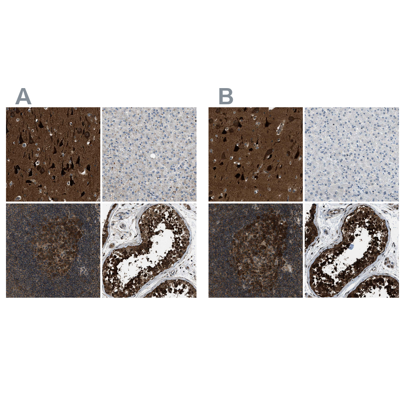 Atlas Antibodies Anti-NUDCD3 Antibody