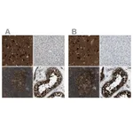 Atlas Antibodies Anti-NUDCD3 Antibody