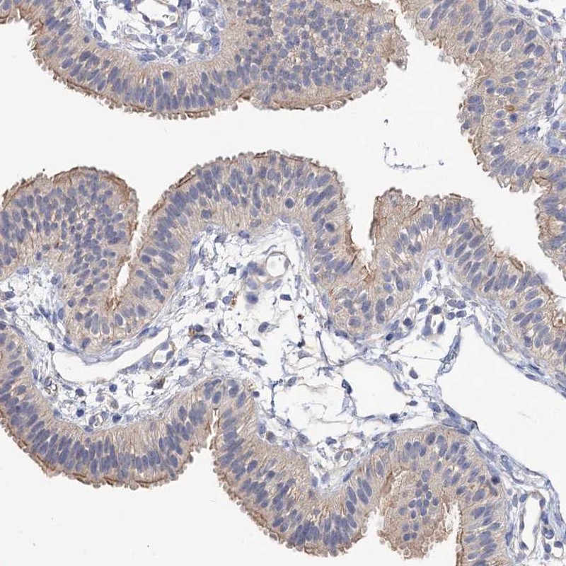 Atlas Antibodies Anti-NUDCD2 Antibody