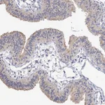 Atlas Antibodies Anti-NUDCD2 Antibody