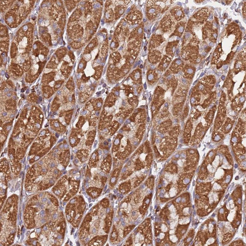 Atlas Antibodies Anti-NUDT12 Antibody
