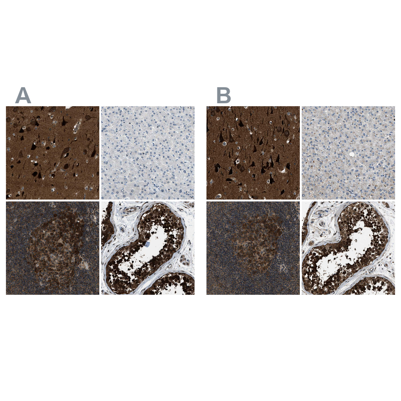 Atlas Antibodies Anti-NUDCD3 Antibody