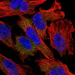 Atlas Antibodies Anti-NUDT10 Antibody