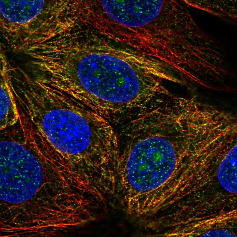 Atlas Antibodies Anti-NUDT14 Antibody